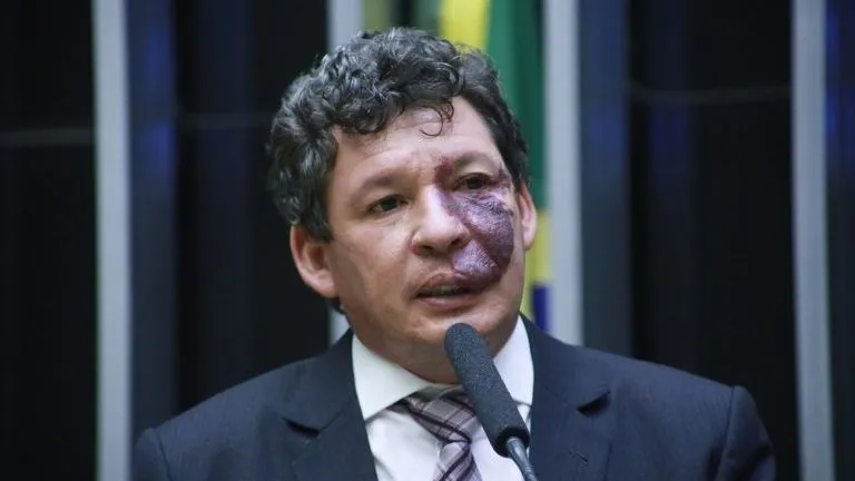 deputado reginaldo lopes (foto Paulo Sérgio/Ag6encia Câmara)